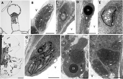 The Effect of Light on Plastid Differentiation, Chlorophyll Biosynthesis, and Essential Oil Composition in Rosemary (Rosmarinus officinalis) Leaves and Cotyledons